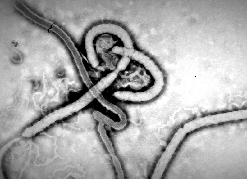 Virus Ebola, ampliado