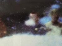 Fotografía mejorada digitalmente de la testigo Mary Moorman