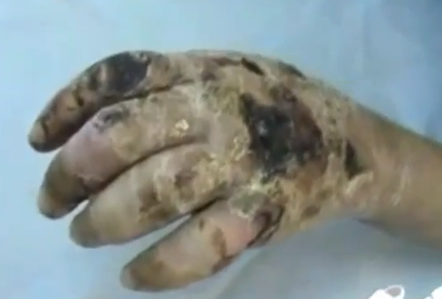 Krokodil, efectos