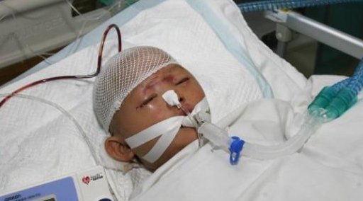 Yue Yue, niña atropellada